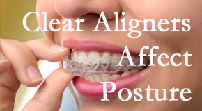 Clear aligners influence posture which New York City chiropractic helps.