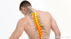 New York City thoracic spine pain image