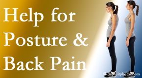 Poor posture and back pain are linked and find help and relief at Rosenberg Wellness Center.