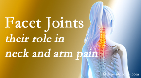 Rosenberg Wellness Center thoroughly examines, diagnoses, and treats cervical spine facet joints for neck pain relief when they are involved.