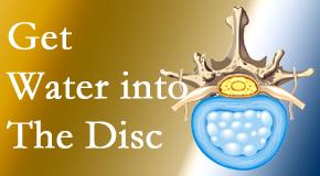 Rosenberg Wellness Center uses spinal manipulation and exercise to enhance the diffusion of water into the disc which supports the health of the disc.