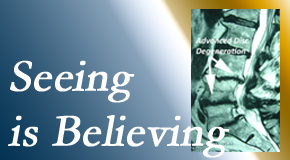 Rosenberg Wellness Center understands how “seeing [imaging – xray or MRI] is believing” works for back pain patients to see the source of their pain. 