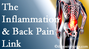 Rosenberg Wellness Center addresses the inflammatory process that accompanies back pain as well as the pain itself.