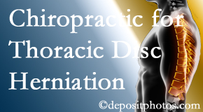 Rosenberg Wellness Center diagnoses and treats thoracic disc herniation pain and relieves its symptoms like unexplained abdominal pain or other gastrointestinal issues. 