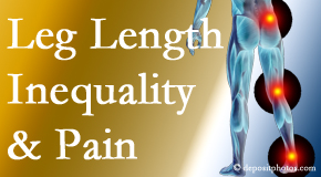 Rosenberg Wellness Center checks for leg length inequality as it is related to back, hip and knee pain issues.