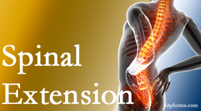 Rosenberg Wellness Center understands the role of extension in spinal motion, its necessity, its benefits and potential harmful effects. 