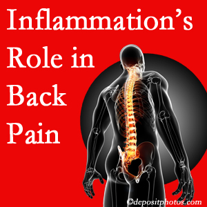 The role of inflammation in New York City back pain is real. Chiropractic care can manage it.