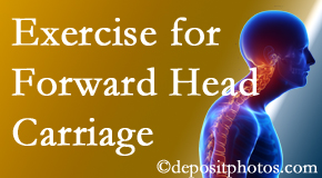 New York City chiropractic treatment of forward head carriage is two-fold: manipulation and exercise.