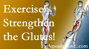 New York City chiropractic care at Rosenberg Wellness Center includes exercise to strengthen glutes.