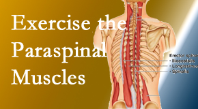 Rosenberg Wellness Center describes the importance of paraspinal muscles and their strength for New York City back pain relief.