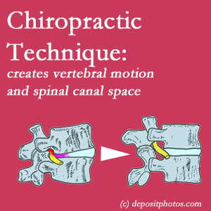 picture of a New York City spinal stenotic canal