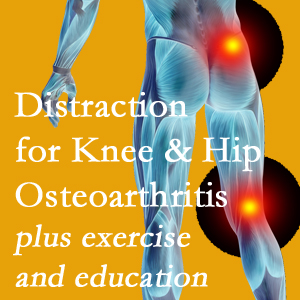 A chiropractic treatment plan for New York City knee pain and hip pain caused by osteoarthritis: education, exercise, distraction.