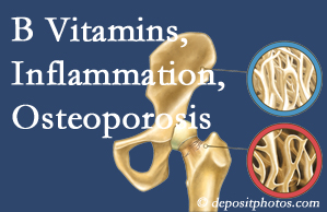 New York City chiropractic care of osteoporosis often comes with nutritional tips like b vitamins for inflammation reduction and for prevention.