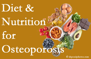 New York City osteoporosis prevention tips from your chiropractor include improved diet and nutrition and decreased sodium, bad fats, and sugar intake. 