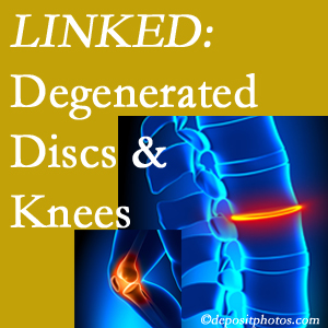 Degenerated discs and degenerated knees are not such unlikely companions. They are seen to be related. New York City patients with a loss of disc height due to disc degeneration often also have knee pain related to degeneration. 