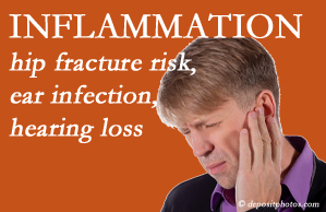 Rosenberg Wellness Center recognizes inflammation’s role in pain and presents how it may be a link between otitis media ear infection and increased hip fracture risk. Interesting research!