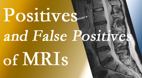 Rosenberg Wellness Center carefully decides when and if MRI images are needed to guide the New York City chiropractic treatment plan. 