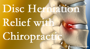 Rosenberg Wellness Center gently treats the disc herniation causing back pain. 